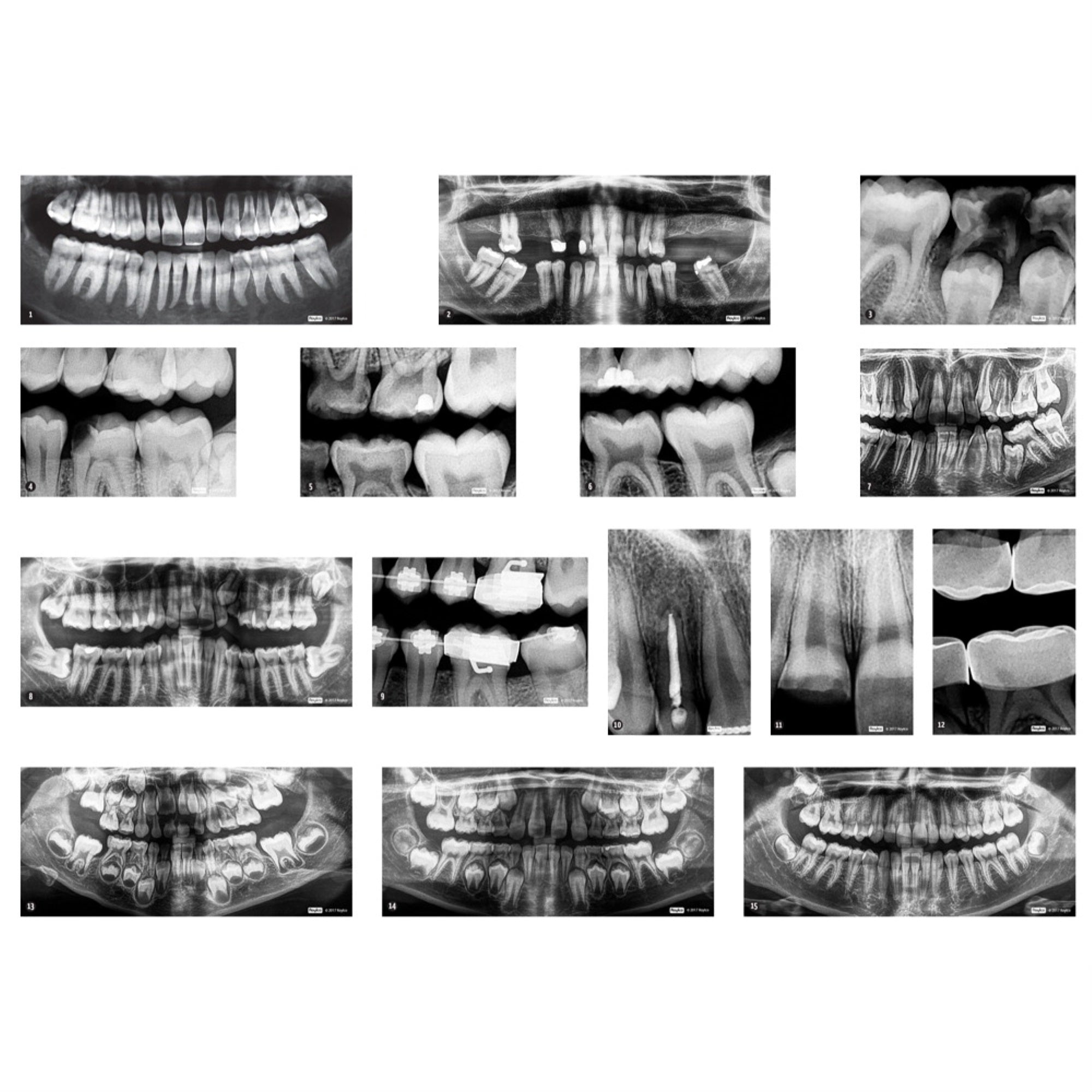 Roylco Dental X-Rays and Charts, 17 Pieces