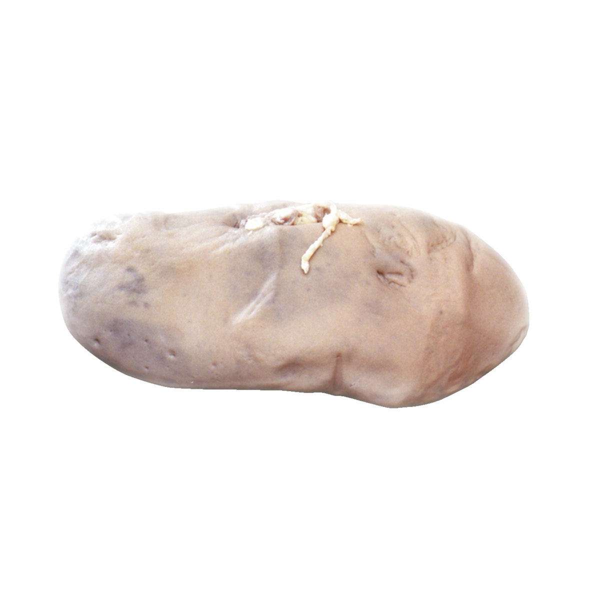 Frey Choice Preserved Pig Organs - Kidneys - Double Injected - Pack Of 10