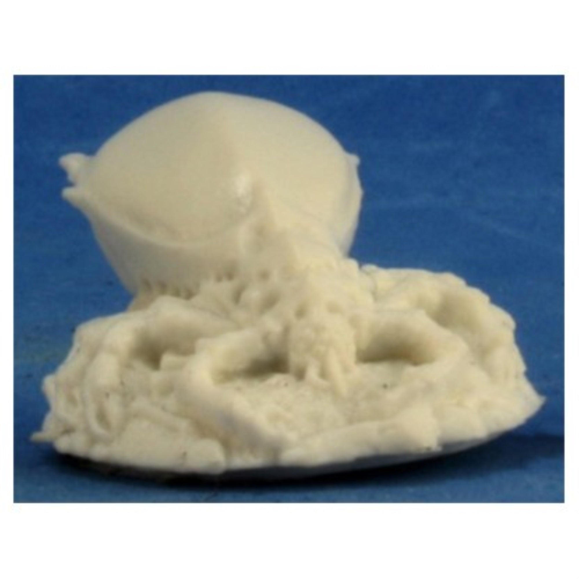 Bones: Sw: Prairie Tick Queen